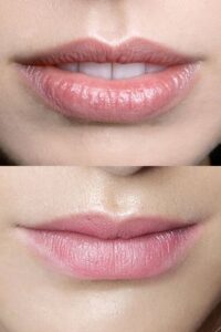 Top 10 Different Lip Shapes For any Event